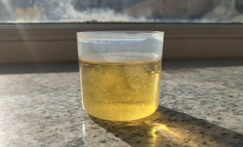 酒精和尿液检测男女准确率高吗